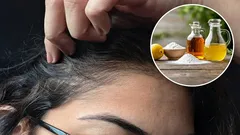 Care sunt avantajele utilizării oțetului și a bicarbonatului de sodiu pentru eliminarea părului alb și cum se procedează corect?